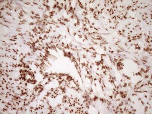 NUDT21 Antibody (aa2-227, clone OTI5B3)