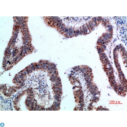 Polyclonal Rabbit anti-Human YARS / Tyrosyl-tRNA Synthetase Antibody (WB)