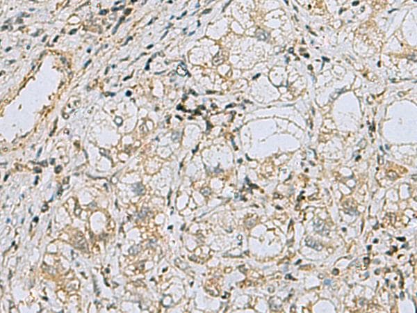 RAB3IP / RABIN3 Antibody
