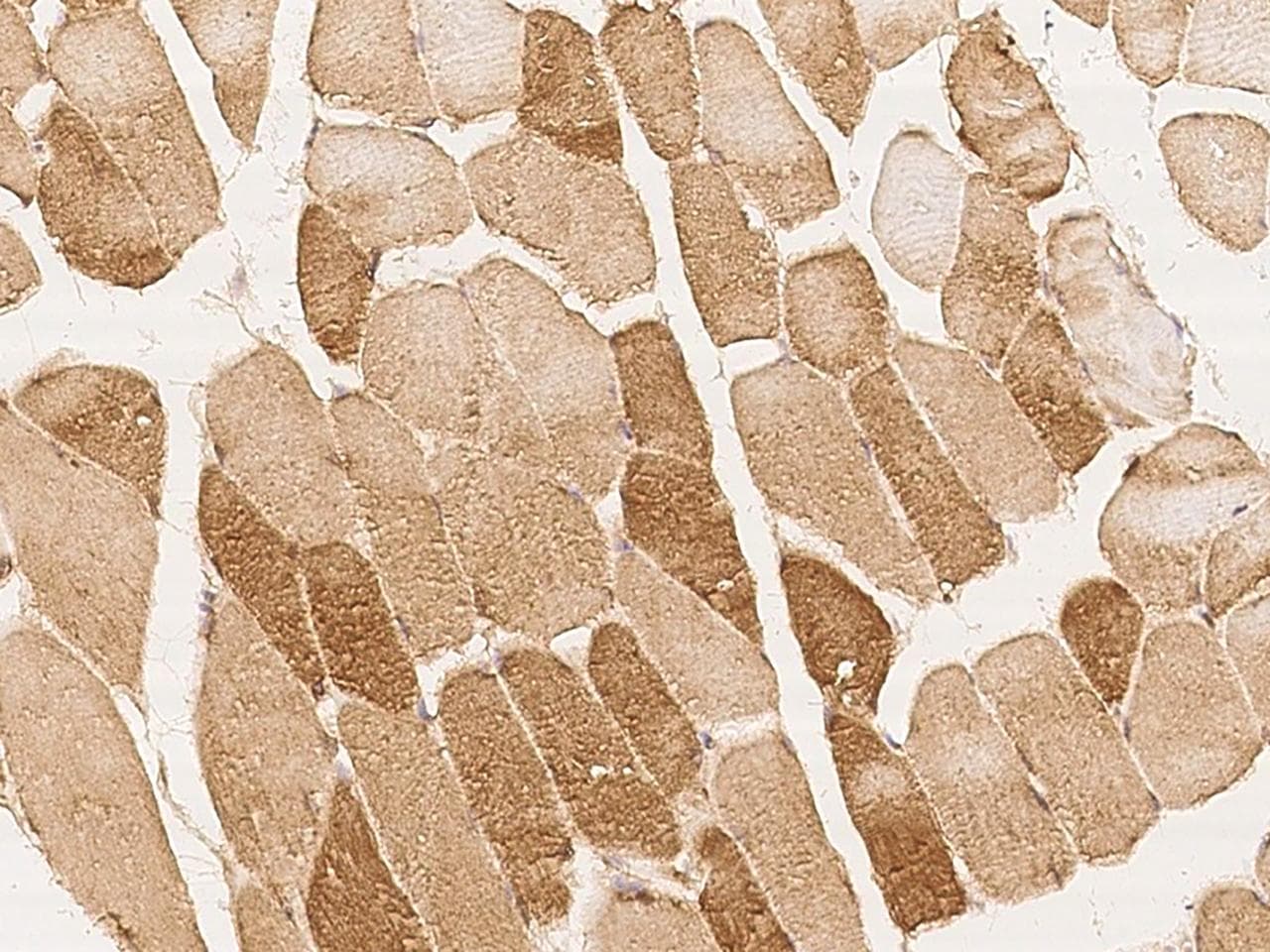 MAP3K10 / MLK2 Antibody