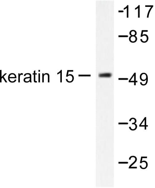 Polyclonal Rabbit anti-Human KRT15 / CK15 / Cytokeratin 15 Antibody (Thr12, IHC, WB)