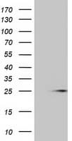 MOB1B / MOBKL1A Antibody (clone OTI1F6)