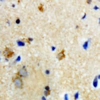 BTD / Biotinidase Antibody (Biotin)