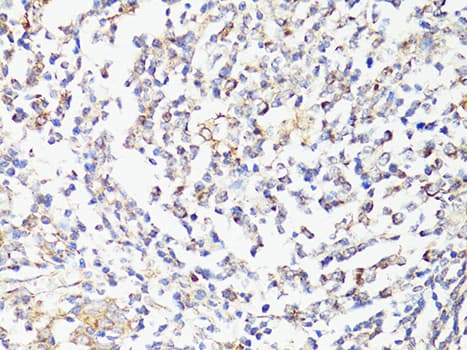 MTOR Antibody