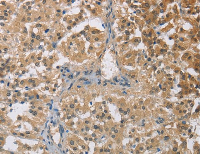 TRAIL-R4 / DCR2 Antibody