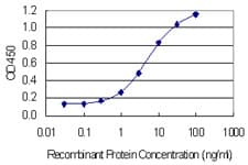 PRPSAP1 Antibody (clone 5H10)