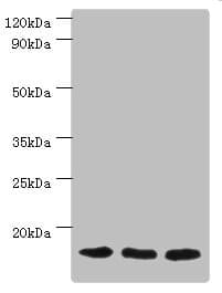 IHC-plus™ Polyclonal Rabbit anti-Human TOMM20 Antibody (aa20-145, IHC, IF, WB)