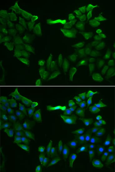 SLC5A6 / SMVT Antibody
