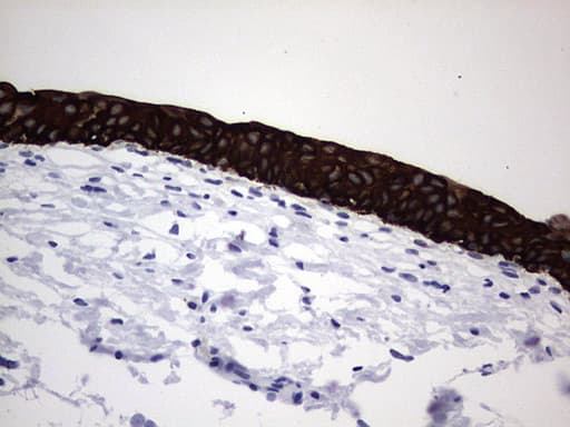 IHC-plus™ Acidic Cytokeratin Antibody (clone 1D10)