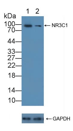 NR3C1/Glucocorticoid Receptor Antibody (aa532-730)
