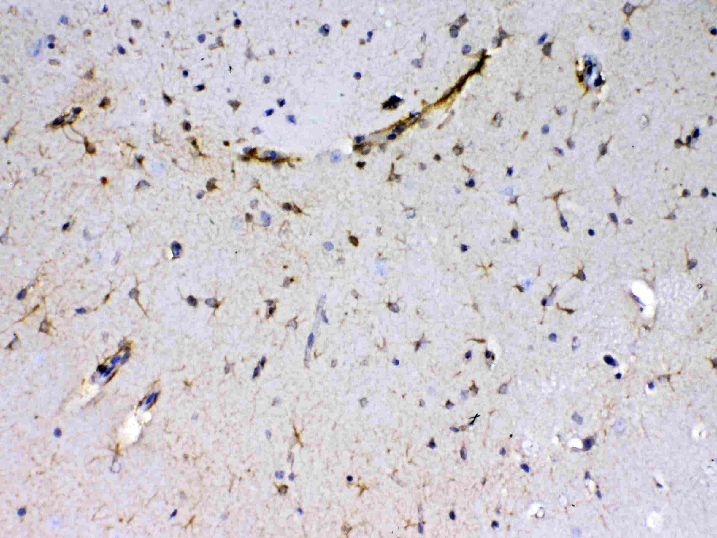 SACS / Sacsin Antibody