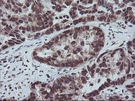 FMR1 / FMRP Antibody (aa36-279, clone OTI5B9)