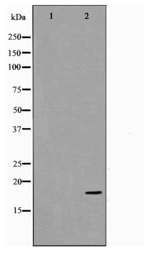CDKN2C / p18 INK4c Antibody