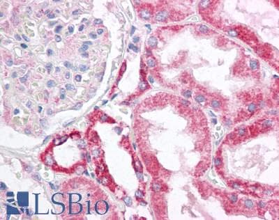 IHC-plus™ Polyclonal Rabbit anti-Human TOMM20 Antibody (aa20-145, IHC, IF, WB)