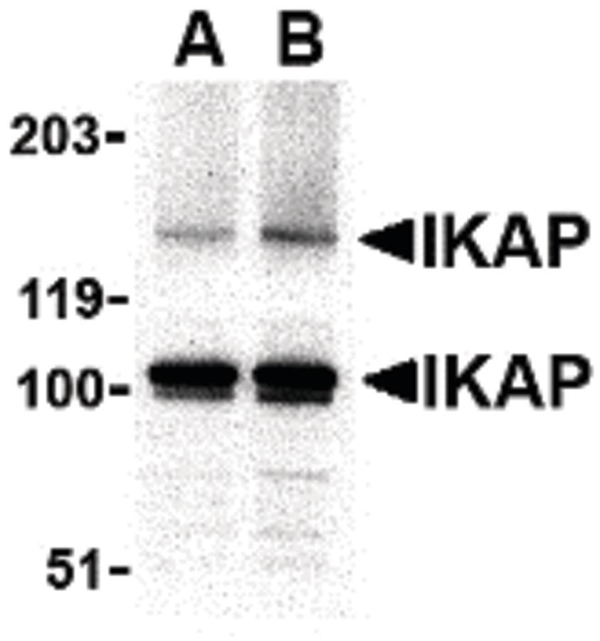 IHC-plus™ Polyclonal Rabbit anti-Human IKBKAP / IKAP Antibody (IHC, IF, WB)