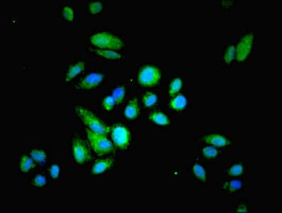 Polyclonal Rabbit anti-Human HRSP12 / UK114 Antibody