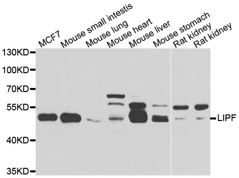 LIPF / GL / Gastric Lipase Antibody