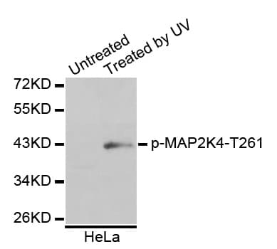 MAP2K4 / MKK4 Antibody (phospho-Thr261, AP)
