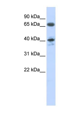 Polyclonal Rabbit anti-Human AGTR1 / AT1 Receptor Antibody (aa37-86, WB)