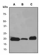 IHC-plus™ Monoclonal Rabbit anti-Human MB / Myoglobin Antibody (clone EPR2581Y, C-Terminus, IHC, WB)