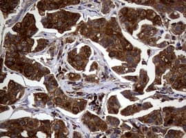 NME1 / NM23 Antibody (clone OTI22F10)