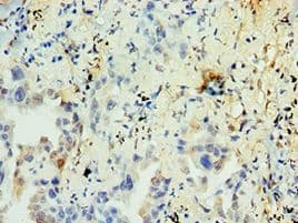 NR2C2 / TAK1 Antibody (aa240-380)