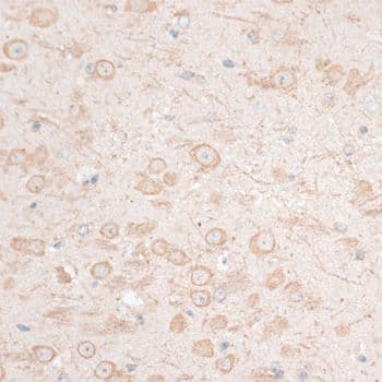 HMGIY / HMGA1 Antibody