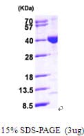 Human MECR Protein (Recombinant His)