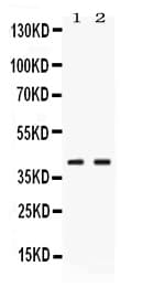 PSAT1 Antibody