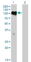 IHC-plus™ Monoclonal Mouse anti-Human MPS1 / TTK Antibody (clone 3G7, IHC, WB)