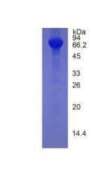 Human HRG Protein (Recombinant His, N-Terminal)