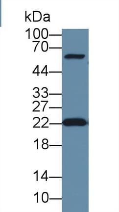Thymidylate Kinase Antibody