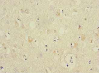 ANKS1B Antibody