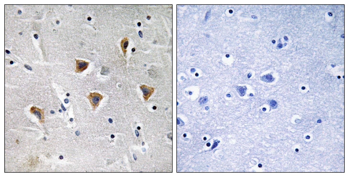 Polyclonal Rabbit anti-Human MTERF1 Antibody (aa267-316, IHC, WB)