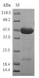 Human STK32A Protein (Recombinant GST, N-terminus)