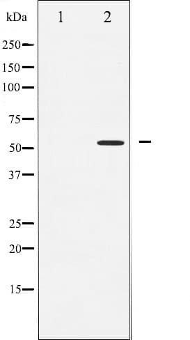 SMAD2 Antibody (phospho-Ser467)