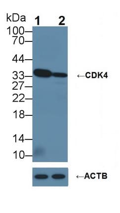 Polyclonal Rabbit anti-Human CDK4 Antibody (aa6-295, WB)