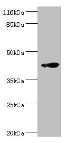 Polyclonal Rabbit anti-Human RNF133 Antibody (IHC, WB)