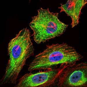Monoclonal Mouse anti-Human GPC3 / Glypican 3 Antibody (clone 9C2, IHC, IF, WB)