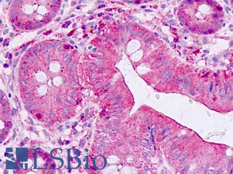 IHC-plus™ SHANK2 / SHANK Antibody (aa331-380)