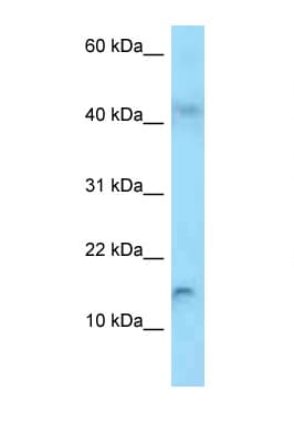 RBP2 / CRBPII Antibody (aa62-111)