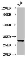 IHC-plus™ Polyclonal Rabbit anti-Human RPA2 / RFA2 / RPA34 Antibody (IHC, WB)