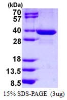 Human SPIN / SPIN1 Protein (Recombinant His)