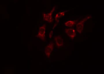DCLK2 / DCAMKL2 Antibody