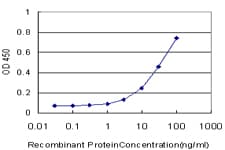 Monoclonal Mouse anti-Human HABP2 Antibody (clone 1H4)