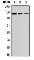 Polyclonal Rabbit anti-Human EIF2AK3 / PERK Antibody (N-Terminus, IHC, WB)