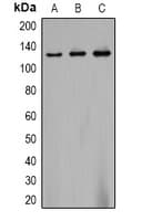 Polyclonal Rabbit anti-Human CACNA2D2 Antibody (IHC, WB)