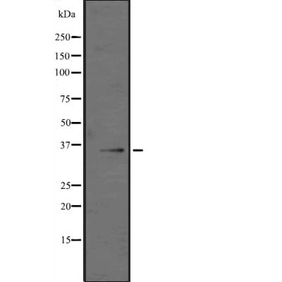Polyclonal Rabbit anti-Human GZMK / Granzyme K Antibody (IHC, IF, WB)