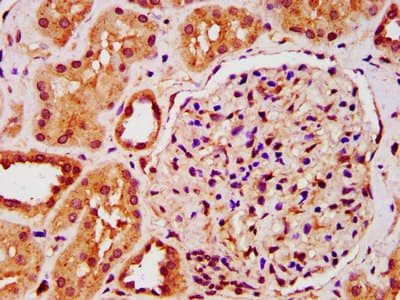 Polyclonal Rabbit anti-Human IST1 Antibody (IHC, IF)