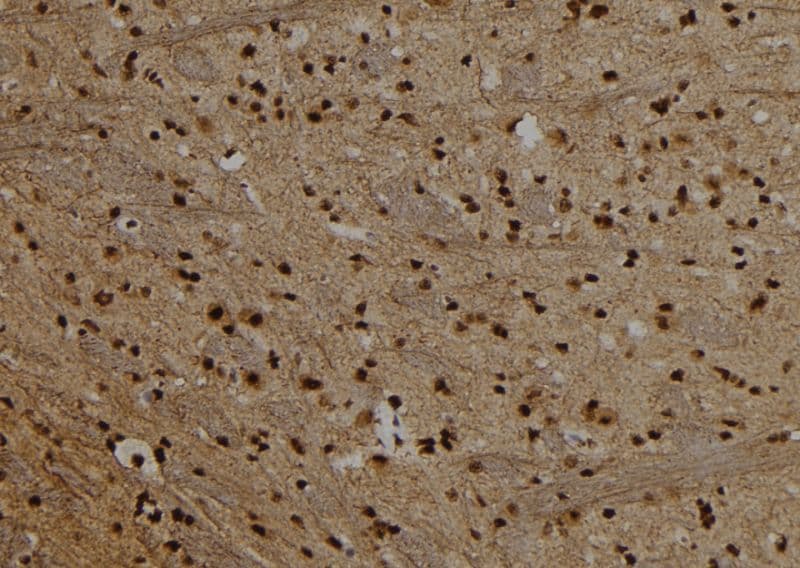PRDM10 / TRIS Antibody